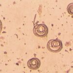 Triquinelosis Toxicología Veterinaria