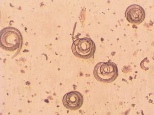 Triquinelosis Toxicología Veterinaria
